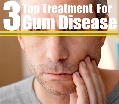 Gum-Disease