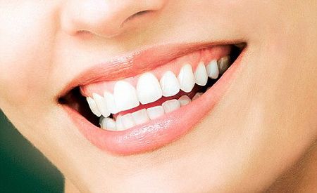 Woman smiling with white teeth