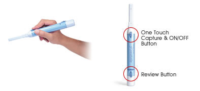 Intraoral Camera Photography