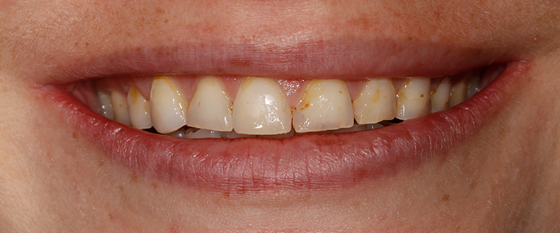 Before image