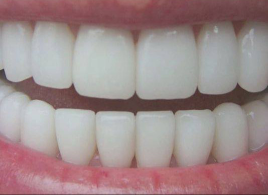 After image