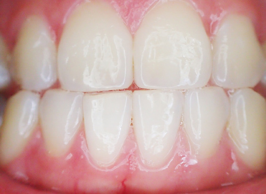 Smile Gallery Art of Modern Dentistry