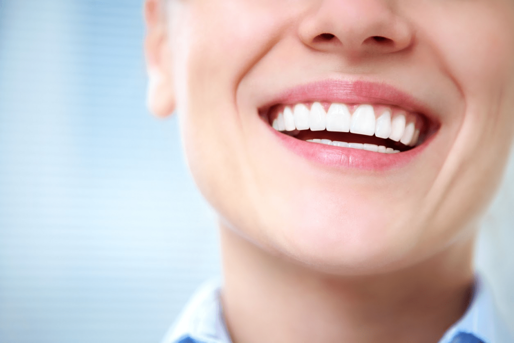 Zoom Teeth Whitening Treatment